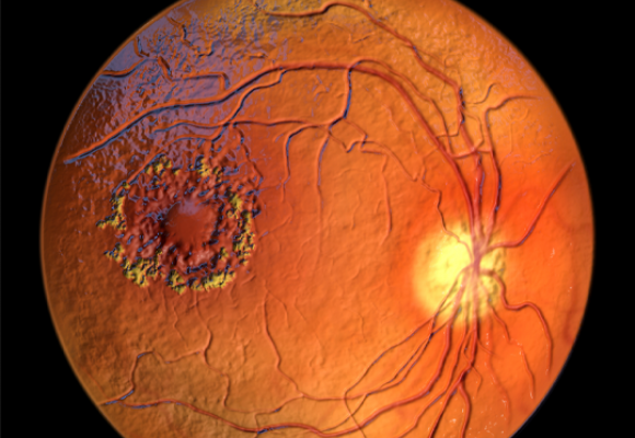 Avanço na detecção precoce da Retinopatia Diabética: Pesquisadores brasileiros identificam sinais antes das lesões na retina